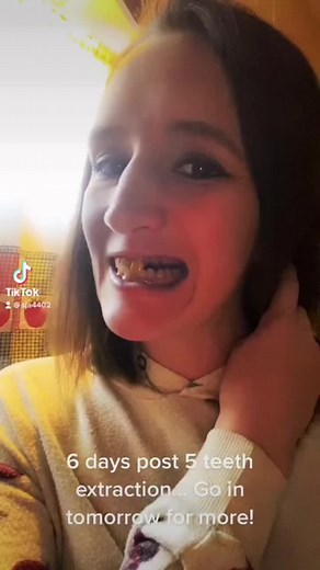 This is my progression of getting my teeth pulled! #dentures #fullmouthextractions #selfimprovement #negativitynotallowed