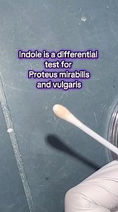 Microbiology 😍 #lablife #microbiology #medicallaboratoryscience | Lab life