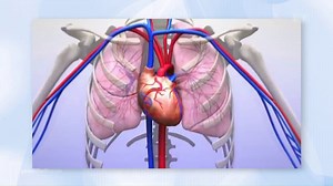 Angina Pectoris - wenn das Herz schmerzt