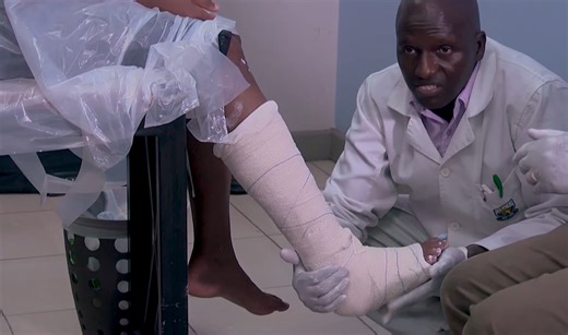 【演示】Below Knee Posterior Slab