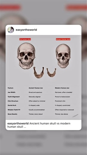 Ancient human skull vs modern human skull #orthodontics #history