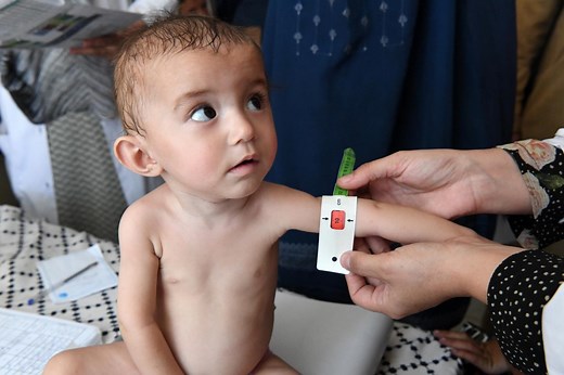 Nutrition and care for children with wasting