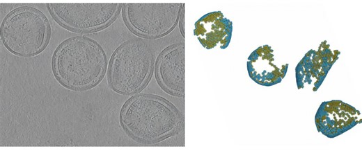 Cancer virus imaging helps uncover potential therapeutic targets