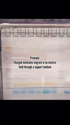 Electrophoresis is a core laboratory technique that separates DNA, RNA, and proteins using an electric field. From hemoglobin variants to serum proteins, this method plays a key role in diagnosis and MLS training. #MedicalLaboratoryScience #Electrophoresis #MedLabEducation #MLSCommunity #ClinicalDiagnostics | Health knowledge explorer