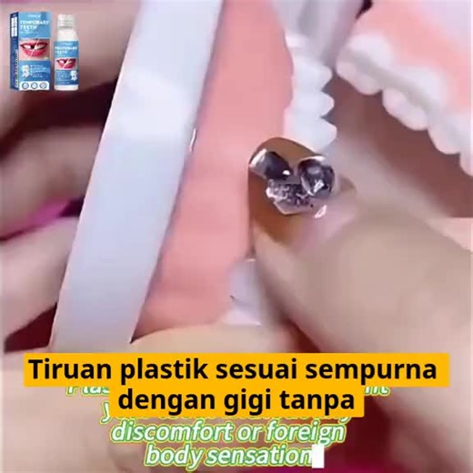Cara Guna TempTooth untuk Gigi Sempurna
