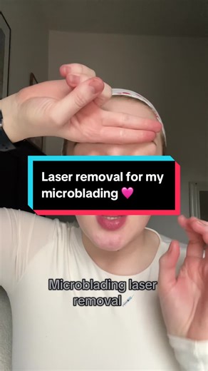 Microblading Removal: My Laser Journey Explained