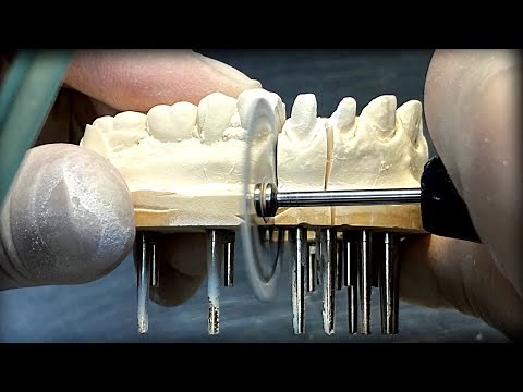 How to Make a Fixed Pin Model, Full Process | Step-By-Step