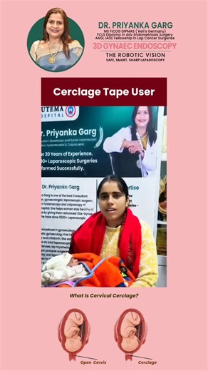 Dr Priyanka Garg on Instagram: "✨ Patient Review Highlight ✨ Another positive experience shared for Cerclage Tape under the care of Dr. Priyanka Garg. Trusted guidance, precise treatment, and compassionate support continue to make every patient journey smoother and safer. 💙👩‍⚕️ Your trust inspires better care, every day. 📍 Nutema Hospital, Opp. LLRM Medical College, Garh Road, Meerut 📞 +91-9837056193 #DrPriyankaGarg #PatientReview #CerclageTape #WomenCare #Gynaeco