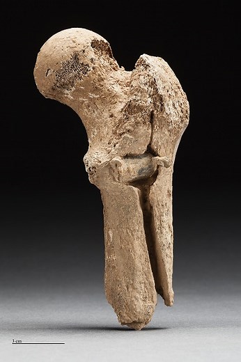 Unprecedented discovery: Remains of Civil War soldiers and field hospital found at Manassas National Battlefield - Manassas National Battlefield Park (U.S. National Park Service)