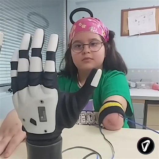 The COVVI Hand is enabled by an innovative actuator design and comes in three different sizes, all of which operate with next-level grip force (70N) and speed (0.4s Tripod grip) capabilities. It also has a three-way digit control system, in addition to a built-in E-Paper screen that can display notifications, troubleshooting issues and information during set-up. Video Credit: COVVI #engineering #technology #bionics #bionichand ----------------------- Wanna get your company on Wevolver too? Learn