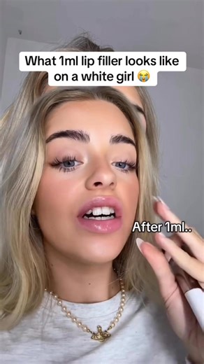 Get yours👄🔥2x volumizing lip plumper #beautyhack #tutorial | Plumpology.lips