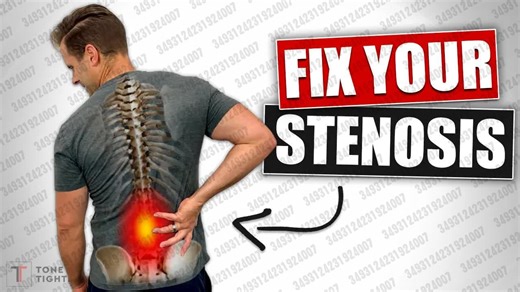 2024.12.12 【Tone and Tighten】修复下背部狭窄和坐骨神经痛！ [DDD 和关节炎的家庭锻炼]