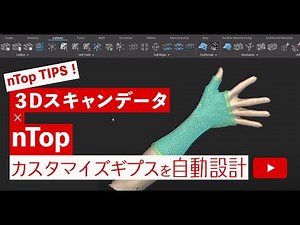 【3Dスキャンデータ×nTop】カスタマイズギプスを自動設計