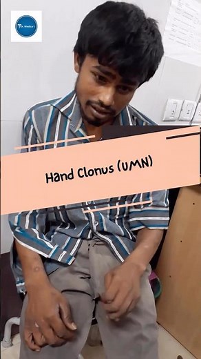 Dr Medica Clinical Cases || Hand Clonus || UMN lesion || Neurology ||