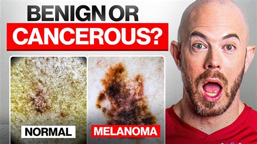 Can You Spot Skin Cancer Real Cases from a Dermatologist's Camera