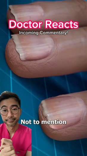 Stop Biting Your Nails