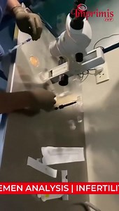 EMBRYO GLUE .. Improved live birth and clinical pregnancy rates with the use of high hyaluronic acid (HA) in embryo transfer media, with one additional live birth achieved for every 14 embryos transferred. Hyaluronic acid at the time of transfer increases the chances of pregnancy Improved FET PGT outcomes for biopsied blastocyst transfer using EmbryoGlue even after short exposures. The use of EmbryoGlue during transfer shows an increase in clinical pregnancy rate and live birth rate. EmbryoGlue 