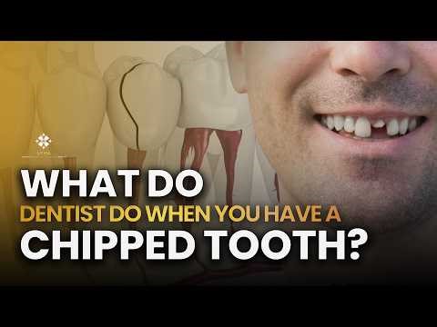 🤍 What Do Dentists Do When You Have a Chipped Tooth? - Lema Dental Clinic