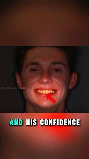 😔 He Hid His Smile for Years… Then This Happened🔥 From Insecure to Confident in 8 Months!