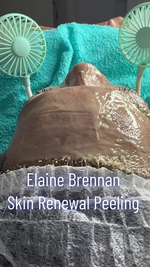 The Elaine Brennan Skin Renewal Peeling costs R6999.00 and includes the follwing, 🌸 Day 1 - 2.5 hours in salon consultation and treatment 1 🌸 Day 2 - 2 hours in salon treatment 2 🌸 Full Face and Neck treatment Day 1 and 2 🌸 Post treatment aftercare ointment for homecare 🌸 1 week post treatment follow up in salon to peel the remaining dead skin 🌸 Daily check in, and support via Whatsapp during the week of your treatment. I will need selfie photo from you every day to assess your progress.We