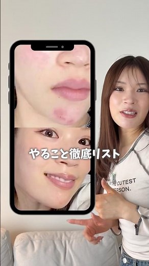 7-Day Acne-Clearing Plan🔥