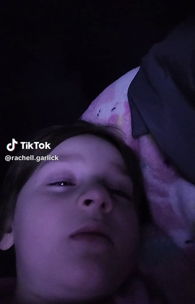 Creepy Phenomenon: Sleeping with Eyes Open