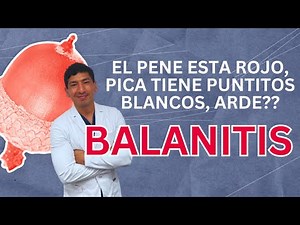 Is your penis red, itchy, or burning? It could be balanitis. | Dr. Muñoz