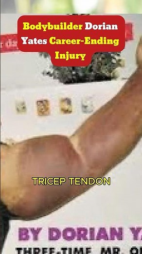 Dorian Yates Career Ending Injury In Bodybuilding -ft. Dorian Yates #bodybuilding