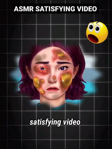 Relax Every Day With Sac Dep Spa | 01 | #acne #blackheads #whiteheads #Treatments #pimple #SacDepSpa #asmr #spa #relievestress #relax #massage #skincare #fypシ #shortvideo #shortsfeed #shortsvideo #shorts #short #foryou #trending #forforyoupage #ownvoice #viral #fyp #reelsfypシ #grow