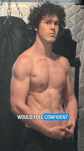 Walter Transformed his Pectus With EXERCISE ONLY!