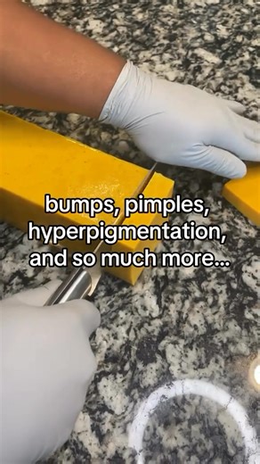 9.1K views · 80 reactions |  Sensitive skin? Oily? Dry? Combo? Doesn’t matter—our turmeric soap was made for all skin types.  ✔️ Fades dark spots ✔️ Balances uneven tone ✔️ Gently exfoliates ✔️ Brightens dull areas ✔️ Calms inflammation This is your sign to switch to a bar that actually works.  Shop now at richandclear.com #RichAndClear #TurmericSoap #SkincareForAll #GlowDifferent #HyperpigmentationHelp #MelaninCare | Rich & Clear Skincare | Facebook
