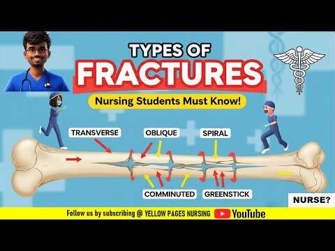 Types of Fractures Made Easy: Nursing Study Guide
