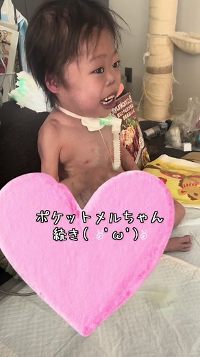 満足そう🤣🤣 #ポケットメルちゃん #メルちゃん #人工呼吸器 #医療的ケア児 #無脾症候群