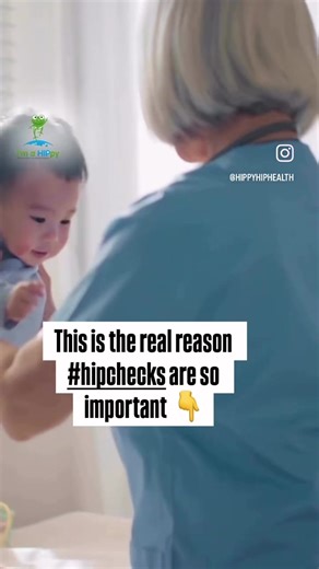 💡 Regular #hipchecks can drastically reduce the chances of hip dysplasia patients needing invasive surgery… In fact, a study at the International Hip Dysplasia Institute found that in babies diagnosed with #hipdysplasia before the age of 6 months, 79% were treated successfully without surgery. That’s why we are on a mission to spread awareness of hip dysplasia and other paediatric hip disorders! These are the important hip check milestones for your newborn: 👉 at birth 👉 4-8 weeks old 👉 6-9 m