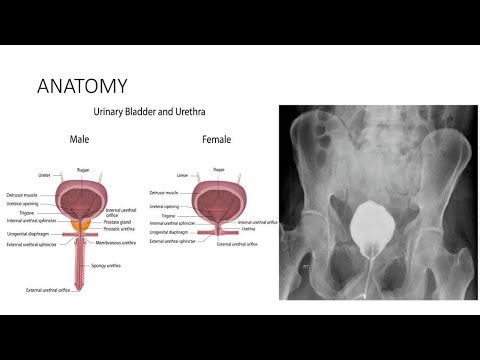 Cystography; specialized radiographic examination of the urinary bladder