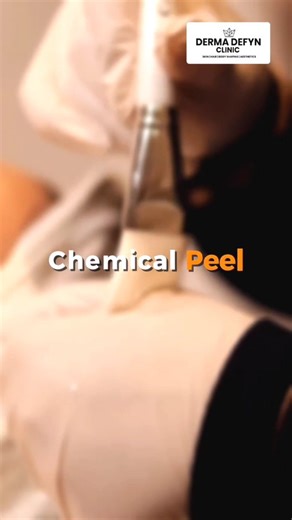 ✨ Chemical Peel = New Skin, New Glow ✨ Dull skin? Dark spots? Acne marks? One solution — Chemical Peels 💧 ✔ Brightens skin ✔ Reduces pigmentation ✔ Improves texture ✔ Gives instant glow Doctor-supervised. Safe. Effective. Book your peel session today! 💖 #DermaDefyn #DermaDefynClinic #SkinClinicDelhi #SkinCareDelhi #ChemicalPeel ChemicalPeelTreatment GlowingSkin ClearSkinJourney PigmentationTreatment | Derma Defyn Green Park