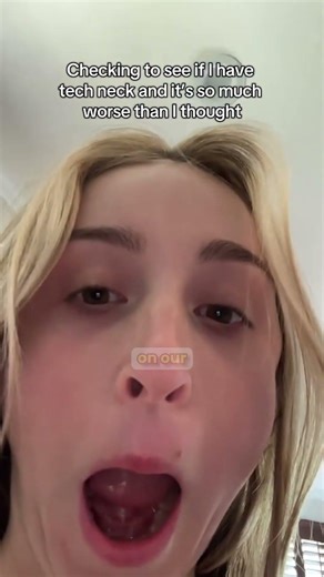 Hunching Over? That’s Tech Neck 📱