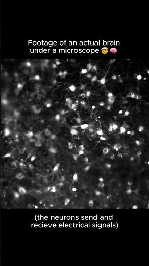 Real footage of neurons sending electrical signal under a microscope