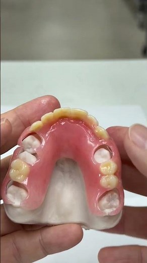 Acrylic partials to replace anterior and some posterior teeth.