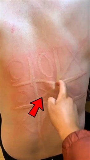 You Can Draw on Skin?!😯