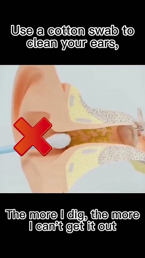 Visual ear scoop safe choice#lowpricesalways #foryou #ear picking tool #visualearpick #earpicker #earpick #decompressedvideo