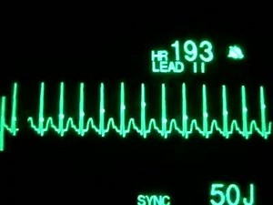 70K views · 1.8K reactions | Perseverence is the name of the game .. | Anesthesia | Facebook