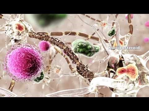 Multiple Sklerose (Deutsch)