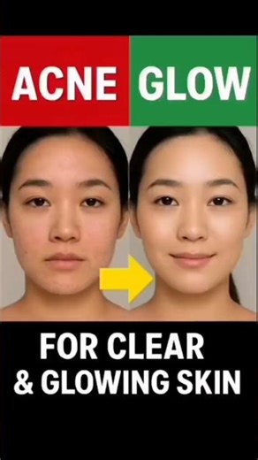 DIY Korean Face Mask | Clear, Glowing & Acne-Free Skin ✨