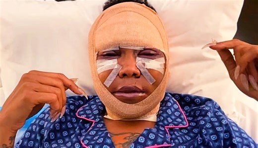 Shock Footage: 'My Killer Body with K. Michelle' Shows Graphic Surgical Damage