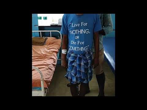 POSITIVE ROMBERG SIGN/ RHOMBERGS TEST