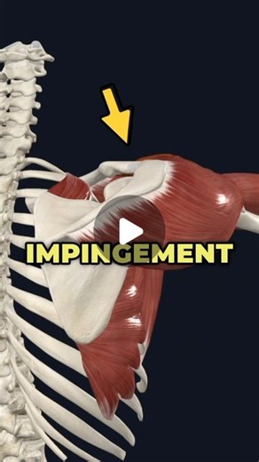 Dr. Adam McCluskey PT, DPT on Instagram: "🚨Things you may NOT know about shoulder impingement! ⬇️...(Full Shoulder Rehab Program @theptinitiative bio link!) . . 👋Maybe you’ve been told shoulder impingement is the cause of your pain. Well I want to clear up a few misconceptions about what this actually is. —- Shoulder impingement is the most commonly used diagnosis for shoulder injuries (Juel 2014) — Shoulder impingement is more of an umbrella term than a specific diagnosis… meaning it could ac