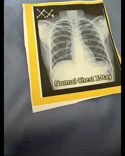 Classic Sesame Street Animation X for X-Ray 🩻