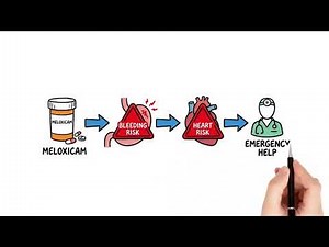 Meloxicam Explained: Uses, Dosage, Side Effects & Safety Tips | Arthritis Pain Relief