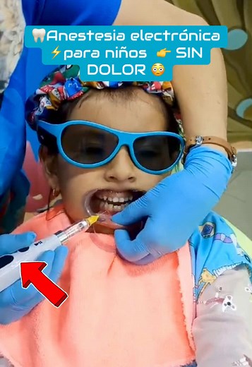 Anestesia Electrónica en Odontología Infantil sin Dolor